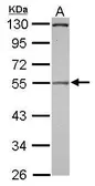 Anti-Pellino 2 antibody [N3C3] used in Western Blot (WB). GTX116399