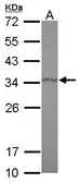 Anti-FAM84A antibody [N1C3] used in Western Blot (WB). GTX116408
