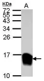 Anti-Galectin 1 antibody used in Western Blot (WB). GTX116411