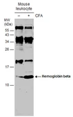 Anti-Hemoglobin beta antibody used in Western Blot (WB). GTX116412