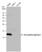 Anti-Hemoglobin gamma A antibody used in Western Blot (WB). GTX116413