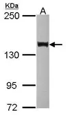 Anti-SIN3B antibody [N1N2-2], N-term used in Western Blot (WB). GTX116417