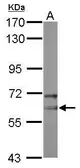 Anti-NOP58 antibody [N1N3] used in Western Blot (WB). GTX116419