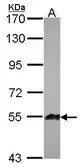 Anti-ANGPTL1 antibody used in Western Blot (WB). GTX116421