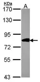 Anti-COG2 antibody [N1N2], N-term used in Western Blot (WB). GTX116423