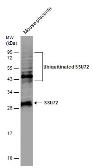 Anti-SSU72 antibody [N1C3] used in Western Blot (WB). GTX116436