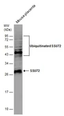 Anti-SSU72 antibody [N1C3] used in Western Blot (WB). GTX116436