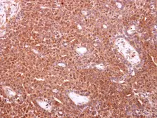 Anti-TOMM34 antibody [N1C3] used in IHC (Paraffin sections) (IHC-P). GTX116439