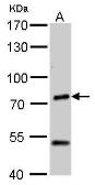 Anti-Chromogranin C antibody used in Western Blot (WB). GTX116446
