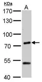Anti-Chromogranin C antibody used in Western Blot (WB). GTX116446
