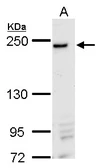 Anti-DNMBP antibody used in Western Blot (WB). GTX116448