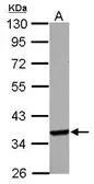 Anti-Langerin antibody [N2C3] used in Western Blot (WB). GTX116461