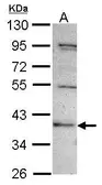 Anti-C2CD2 antibody used in Western Blot (WB). GTX116476