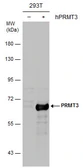 Anti-PRMT3 antibody used in Western Blot (WB). GTX116478