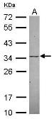 Anti-KChIP2 antibody [N1C3] used in Western Blot (WB). GTX116483