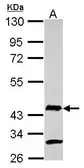 Anti-AIM2 antibody used in Western Blot (WB). GTX116487