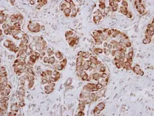 Anti-PKC nu antibody [N1N3] used in IHC (Paraffin sections) (IHC-P). GTX116489