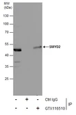 Anti-SMYD2 antibody used in Immunoprecipitation (IP). GTX116510