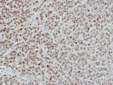 Anti-INTS4 antibody [N1N2], N-term used in IHC (Paraffin sections) (IHC-P). GTX116519