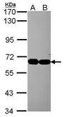 Anti-INTS4 antibody [N1N2], N-term used in Western Blot (WB). GTX116519