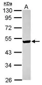 Anti-ILKAP antibody [N2C3] used in Western Blot (WB). GTX116528