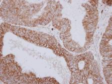 Anti-PNPase antibody used in IHC (Paraffin sections) (IHC-P). GTX116542