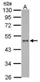 Anti-ZNF71 antibody used in Western Blot (WB). GTX116553