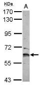 Anti-ZNF83 antibody [C1C3] used in Western Blot (WB). GTX116554
