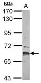 Anti-ZNF83 antibody [C1C3] used in Western Blot (WB). GTX116554