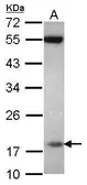 Anti-PPIL3 antibody [N1C3] used in Western Blot (WB). GTX116555