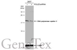 Anti-DNA polymerase epsilon 3 antibody [N1C3] used in Western Blot (WB). GTX116557