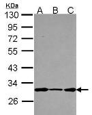 Anti-DCUN1D1 antibody [N2C3] used in Western Blot (WB). GTX116558