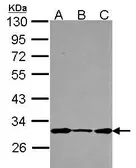 Anti-DCUN1D1 antibody [N2C3] used in Western Blot (WB). GTX116558