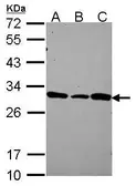 Anti-DCUN1D1 antibody [N1C3] used in Western Blot (WB). GTX116559