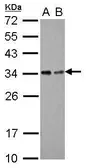 Anti-Tollip antibody [N2C3] used in Western Blot (WB). GTX116566
