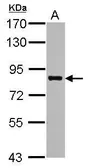Anti-PRMT7 antibody used in Western Blot (WB). GTX116569