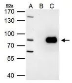 Anti-PRMT7 antibody used in Immunoprecipitation (IP). GTX116570