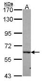 Anti-DDX56 antibody [C1C3] used in Western Blot (WB). GTX116579