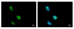 Anti-KLHDC4 antibody used in Immunocytochemistry/ Immunofluorescence (ICC/IF). GTX116585