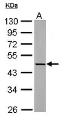 Anti-KLHDC4 antibody used in Western Blot (WB). GTX116585
