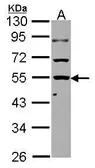 Anti-KLHDC4 antibody used in Western Blot (WB). GTX116586