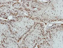Anti-MED18 antibody [N1C3] used in IHC (Paraffin sections) (IHC-P). GTX116587