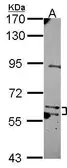 Anti-MKS1 antibody [N2C1], Internal used in Western Blot (WB). GTX116593