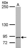Anti-MCTP2 antibody [C1C2], Internal used in Western Blot (WB). GTX116602