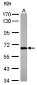 Anti-DDX28 antibody [N2C1], Internal used in Western Blot (WB). GTX116603