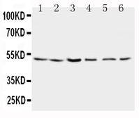 Anti-Presenilin 2 antibody used in Western Blot (WB). GTX11661