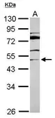 Anti-MDS028 antibody [N1C1] used in Western Blot (WB). GTX116611