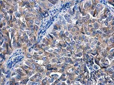 Anti-KIZUNA antibody [N2C1], Internal used in IHC (Paraffin sections) (IHC-P). GTX116612