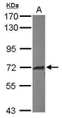 Anti-Myoneurin antibody used in Western Blot (WB). GTX116617