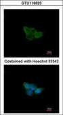 Anti-NXF2 antibody used in Immunocytochemistry/ Immunofluorescence (ICC/IF). GTX116623